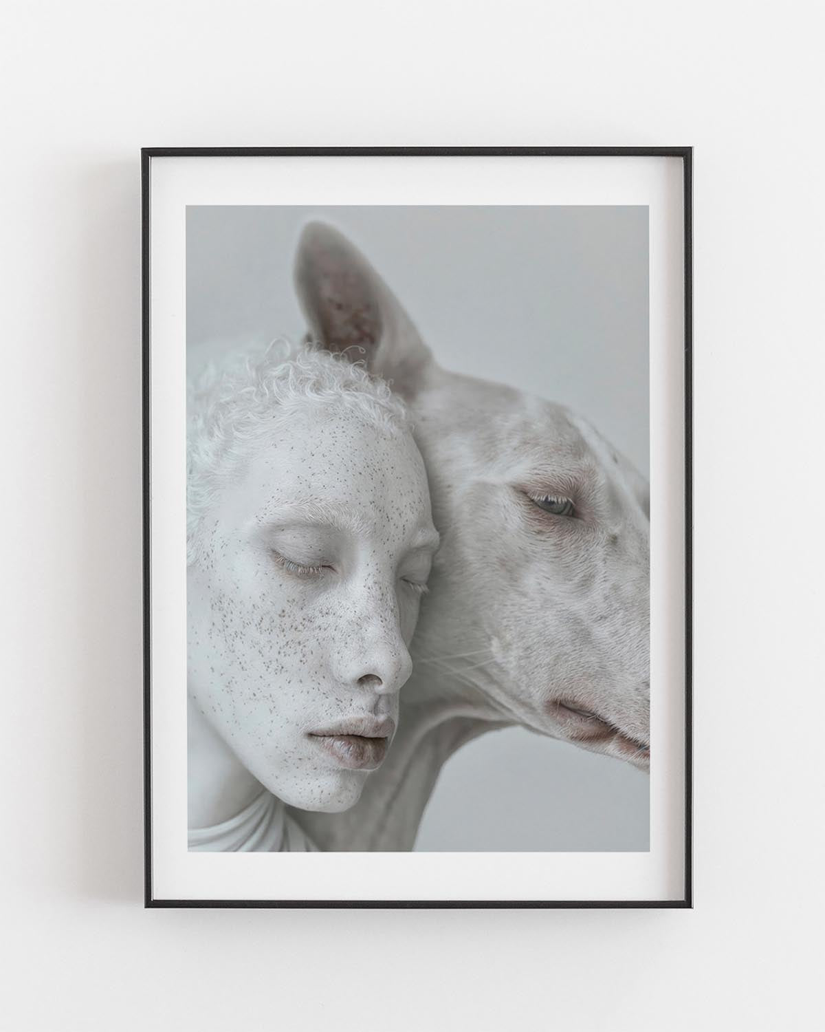 A poster showing an albino person and an albino dog with their heads gently touching, eyes closed in a tranquil moment that highlights their unique beauty and the silent bond they share.